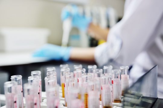a,scientist,in,a,medical,laboratory,with,a,dispenser,in