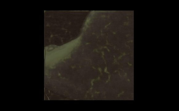 antebrat, ai, the somatist, the entropist, the skeptic