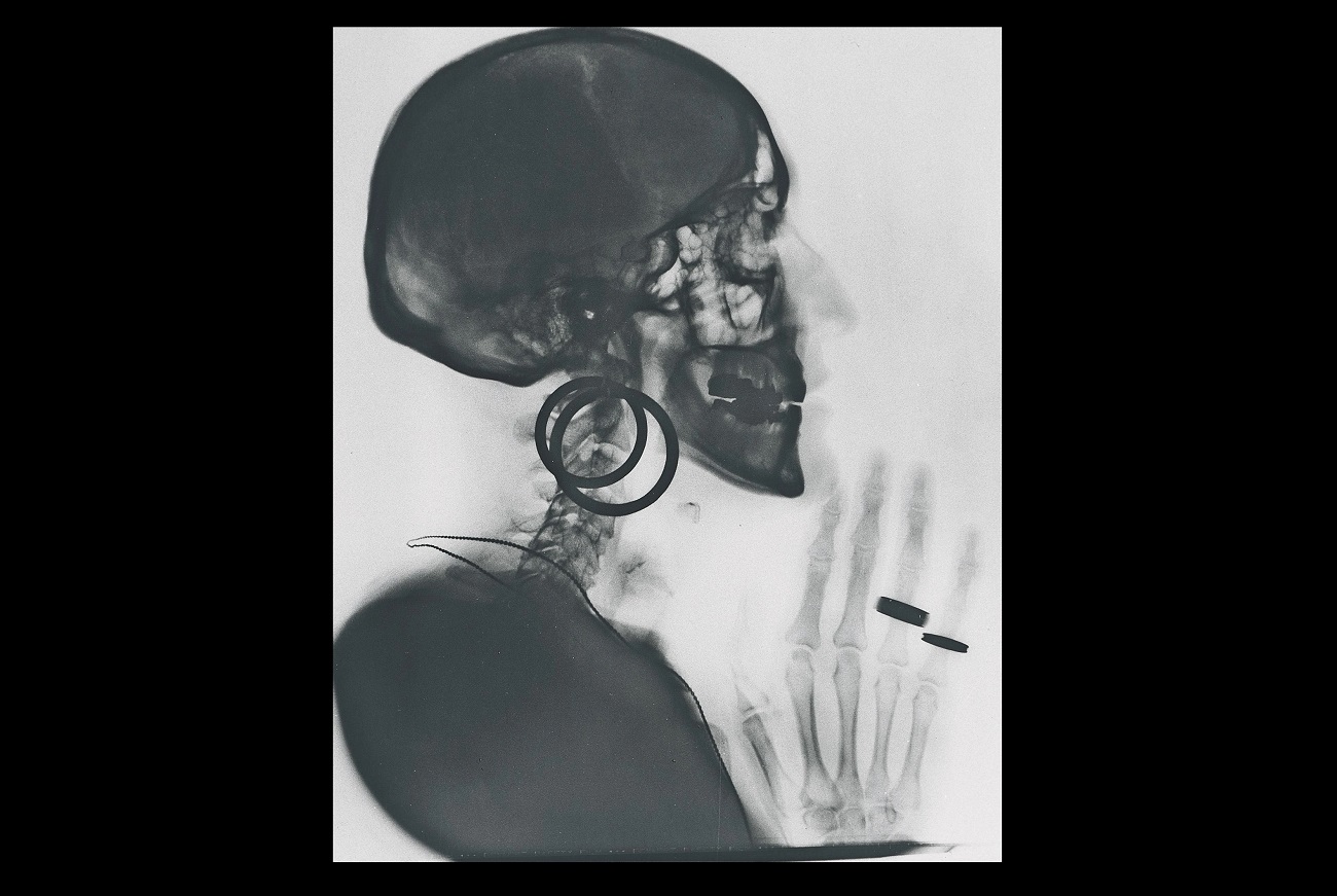 meret oppenheim, x ray of m.o.’s skull, kunstmuseum bern