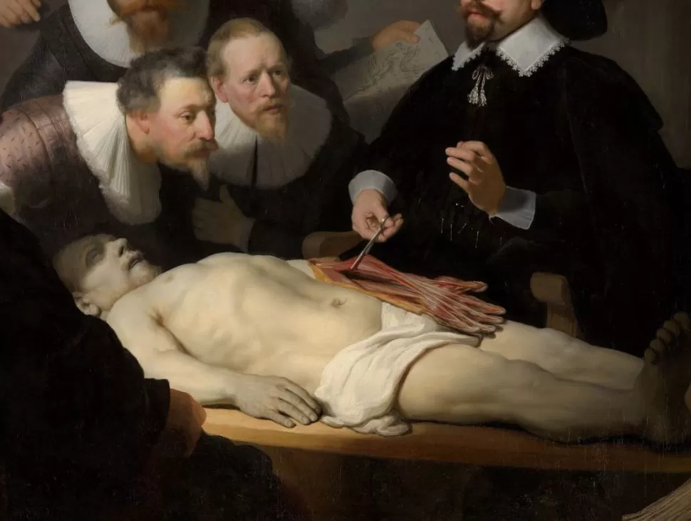 rembrandt the anatomy lesson of dr nicolaes tulp 3