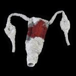 fragile anatomy, magdalena pelmus