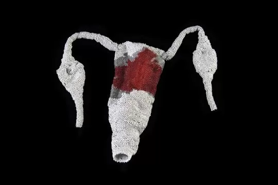 fragile anatomy, magdalena pelmus