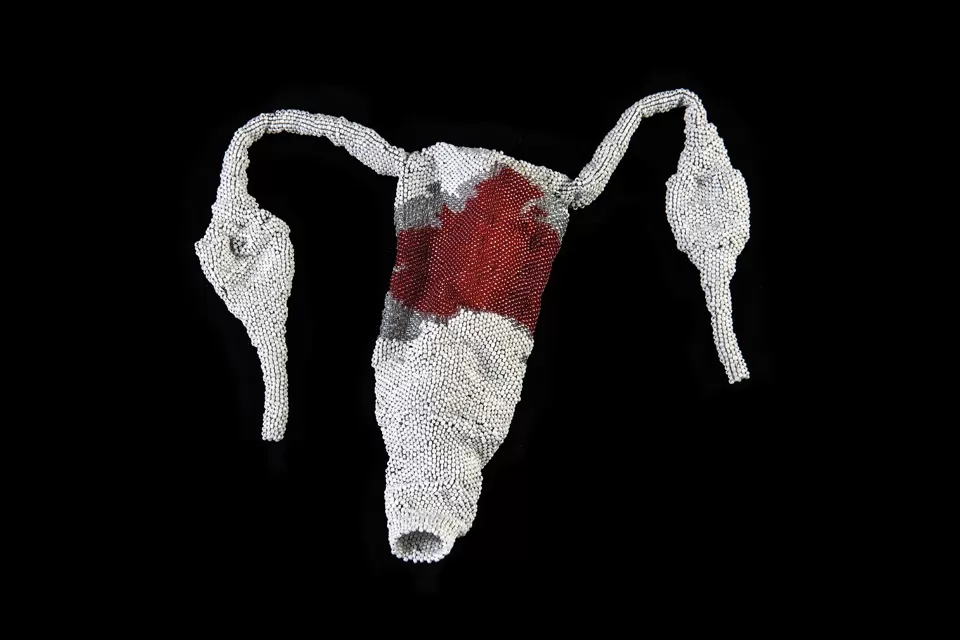 fragile anatomy, magdalena pelmus